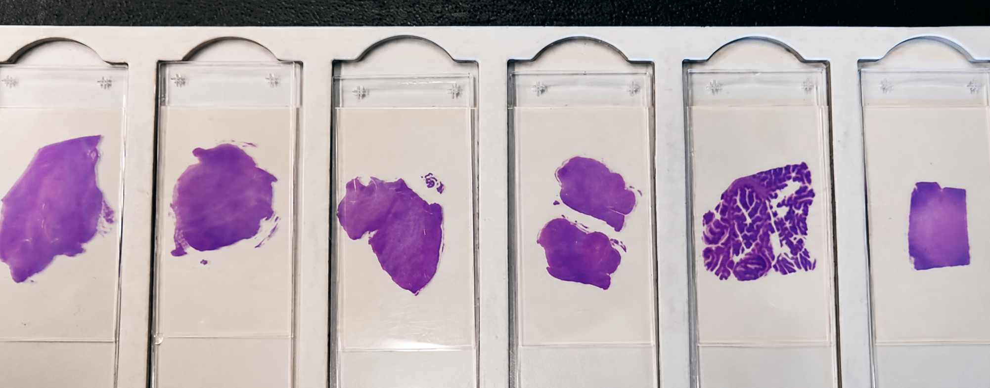 row of slices of brain tissue samples, stained purple